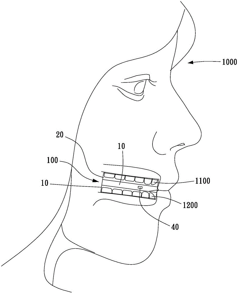 Beauty making method of arranging teeth orderly