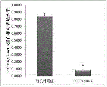 SiRNA (small interfering ribonucleic acid) inhibiting PDCD4 (programmed cell death4) gene expression and application of siRNA