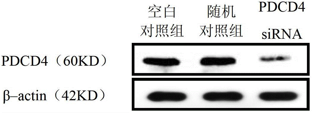 SiRNA (small interfering ribonucleic acid) inhibiting PDCD4 (programmed cell death4) gene expression and application of siRNA