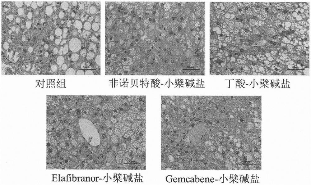 Acid-base addition salts containing berberine, processes for their preparation and their use as medicines