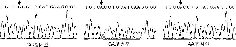 Method for auxiliarily detecting characters of number born of sow and special kit thereof