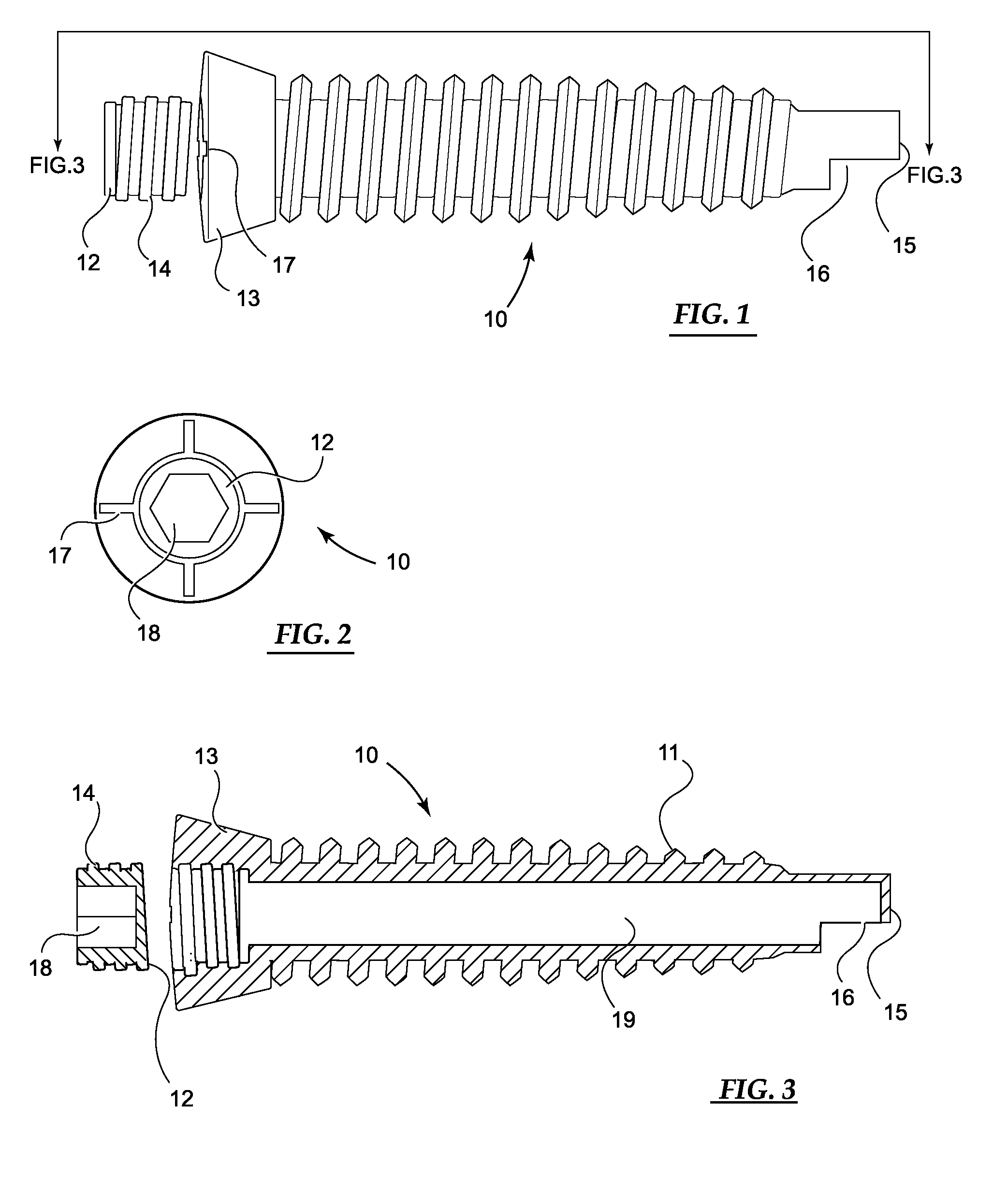 Device and method for orthopedic fracture fixation