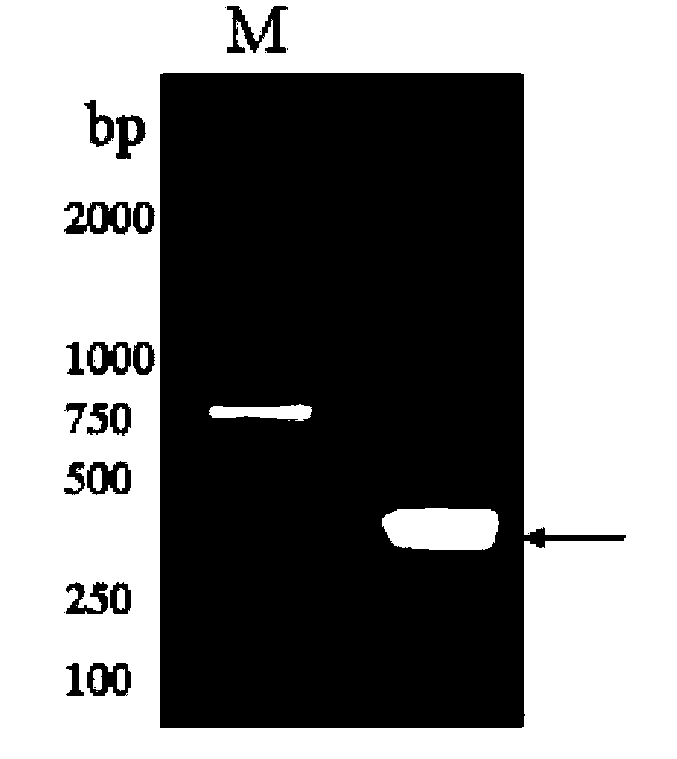 Tick cystatin Rhcyst-2, and gene and applications thereof