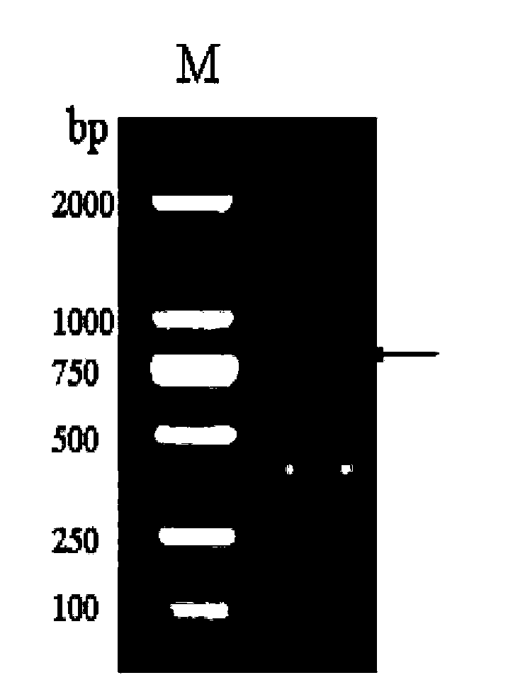 Tick cystatin Rhcyst-2, and gene and applications thereof