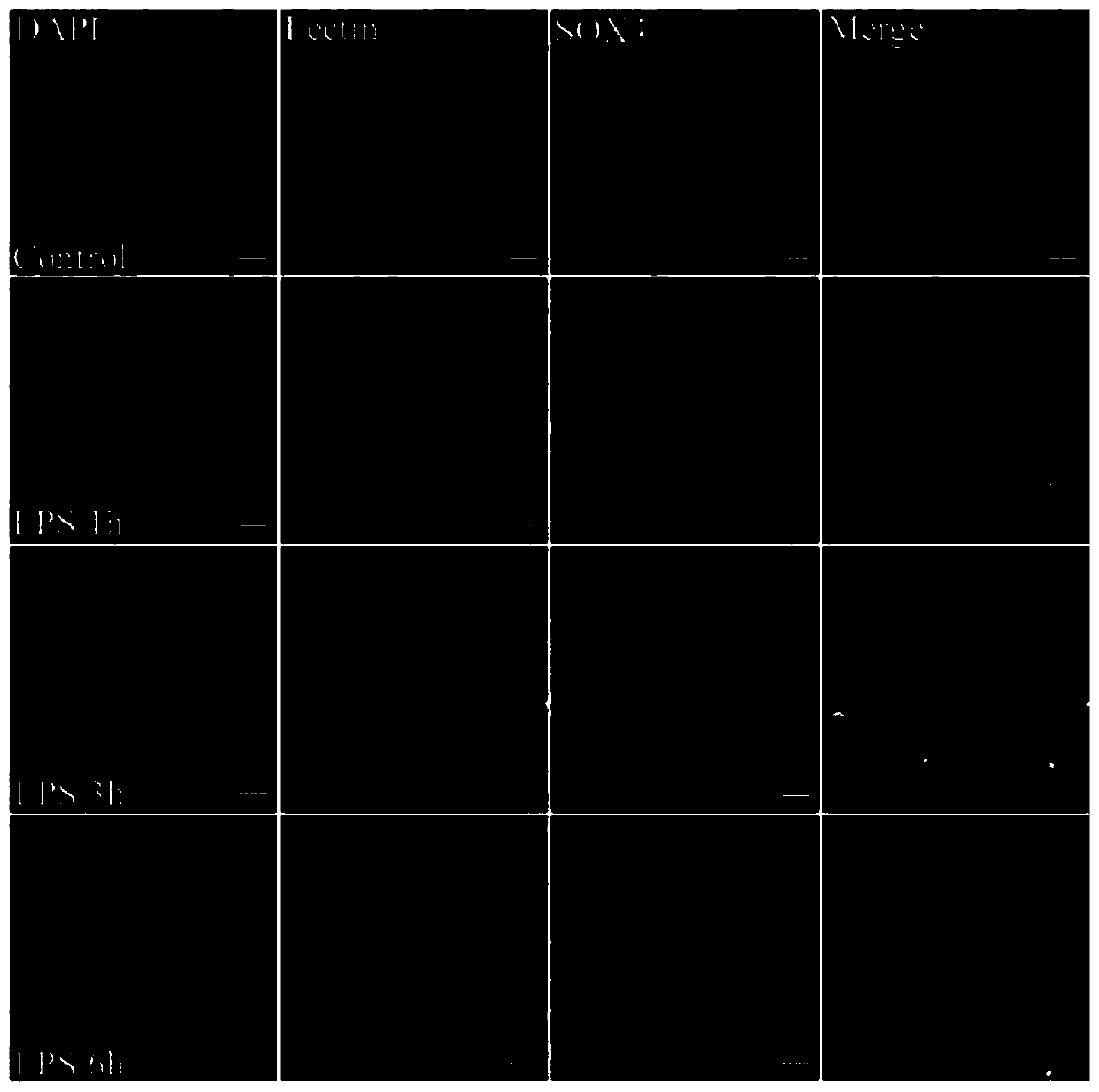 Application of SOX4 inhibitor and medicine containing SOX4 inhibitor