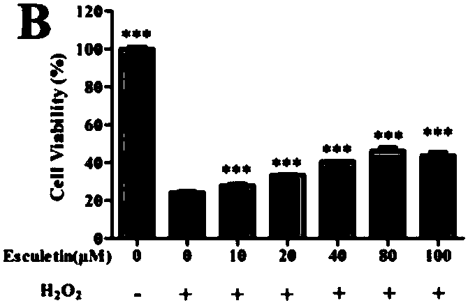 Application of aesculetin to preparation of medicine or health-care product for treating and preventing eye diseases