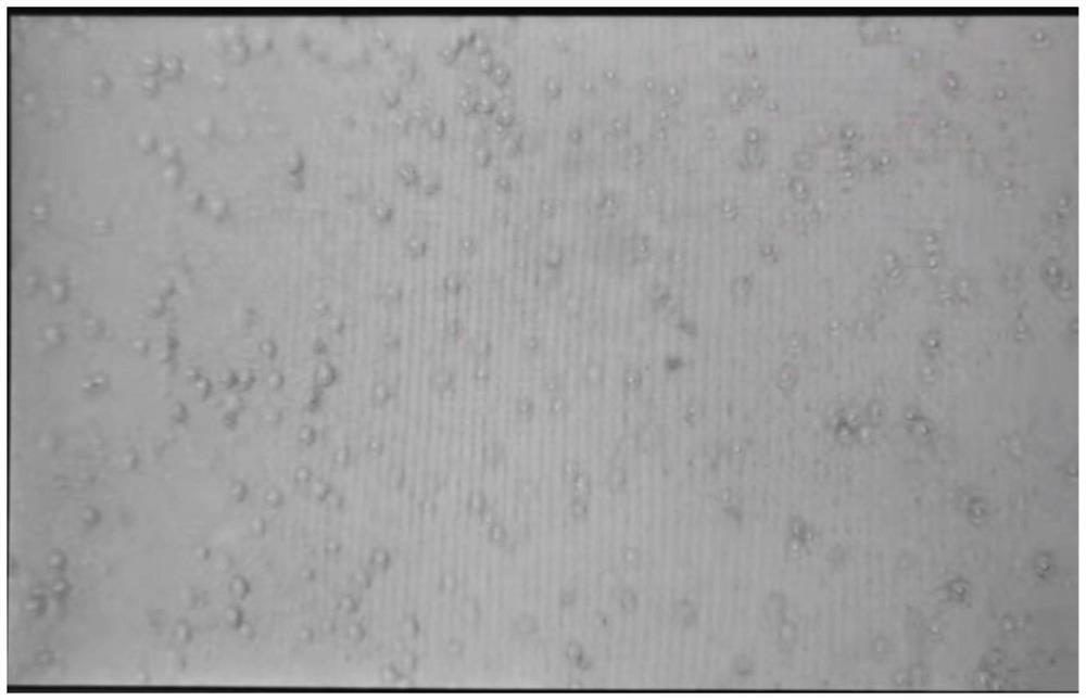 Human bone marrow and umbilical cord blood stem cell treatment kit and stem cell separation method