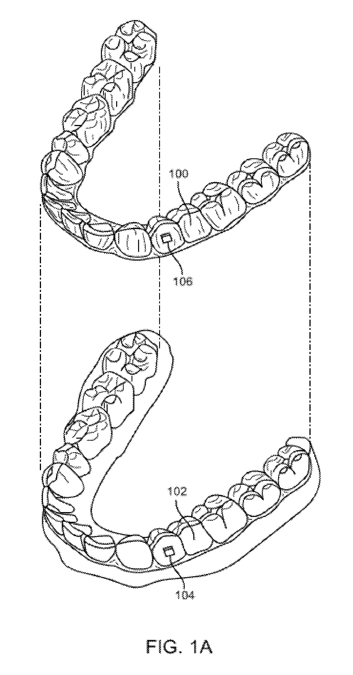 Orthodontic appliance performance monitor