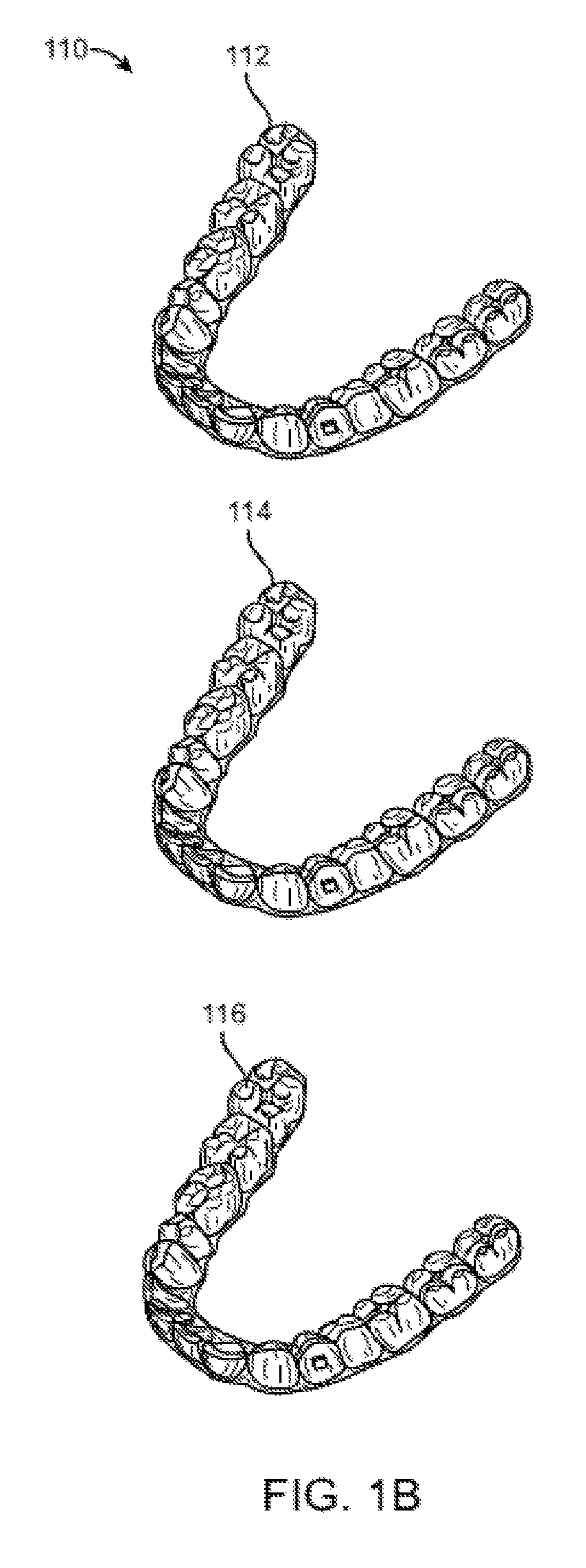 Orthodontic appliance performance monitor