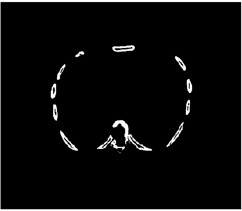 Statistical iteration reconstruction method of sparse-angle X-ray CT (electronic computer X-ray tomography technique) image