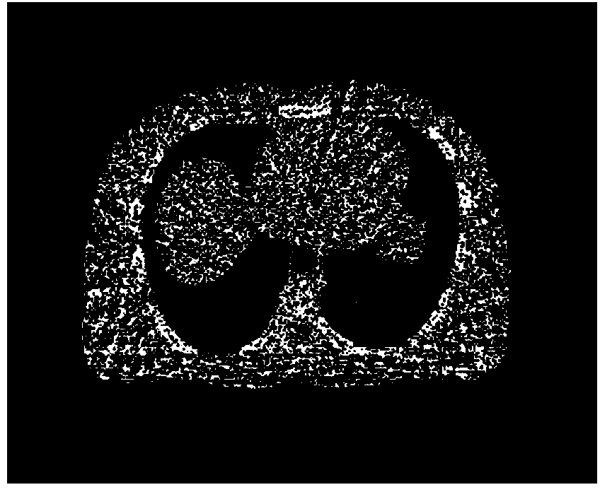 Statistical iteration reconstruction method of sparse-angle X-ray CT (electronic computer X-ray tomography technique) image