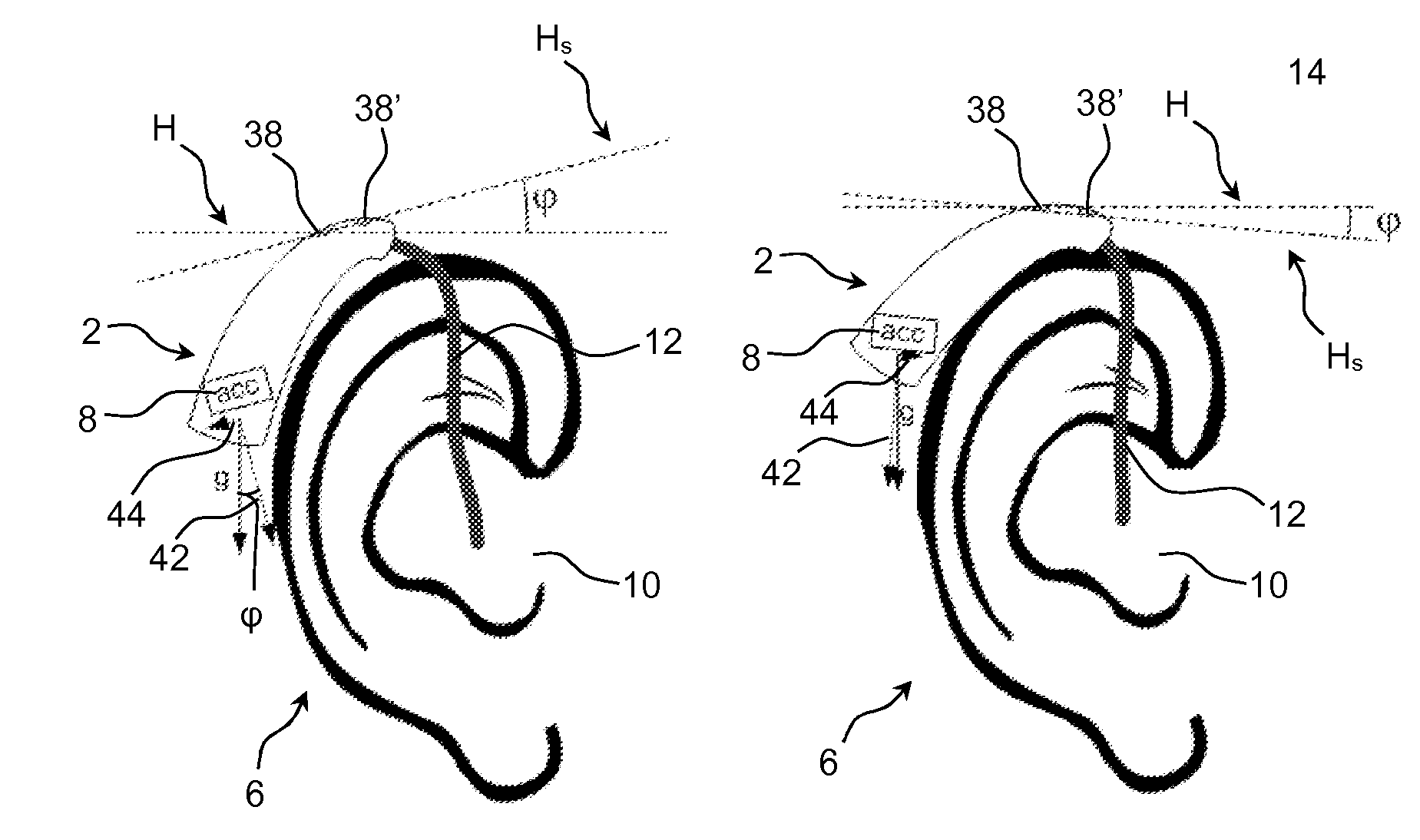 Hearing aid device comprising a sensor member