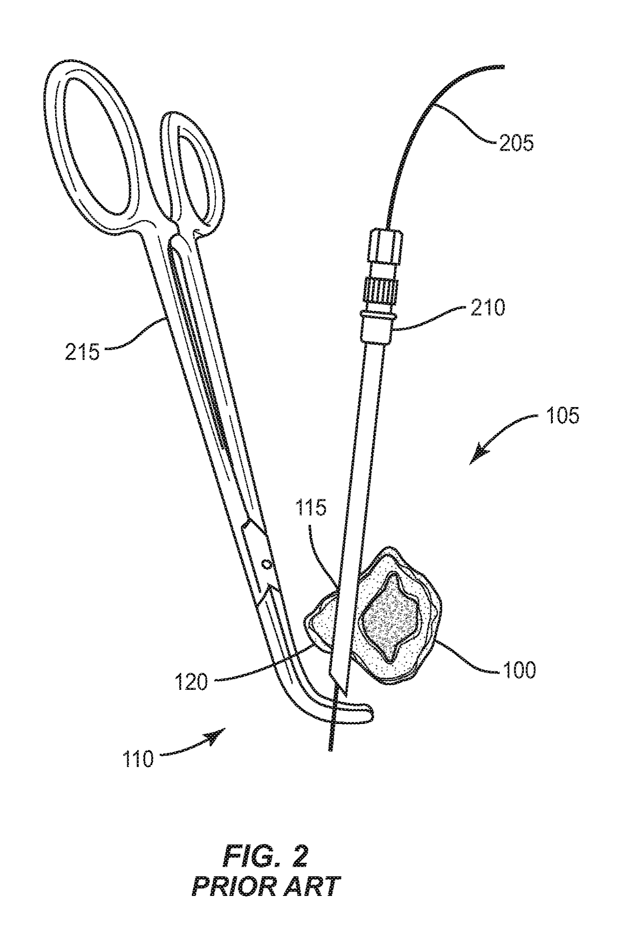 Surgical Anchor and Method of Use