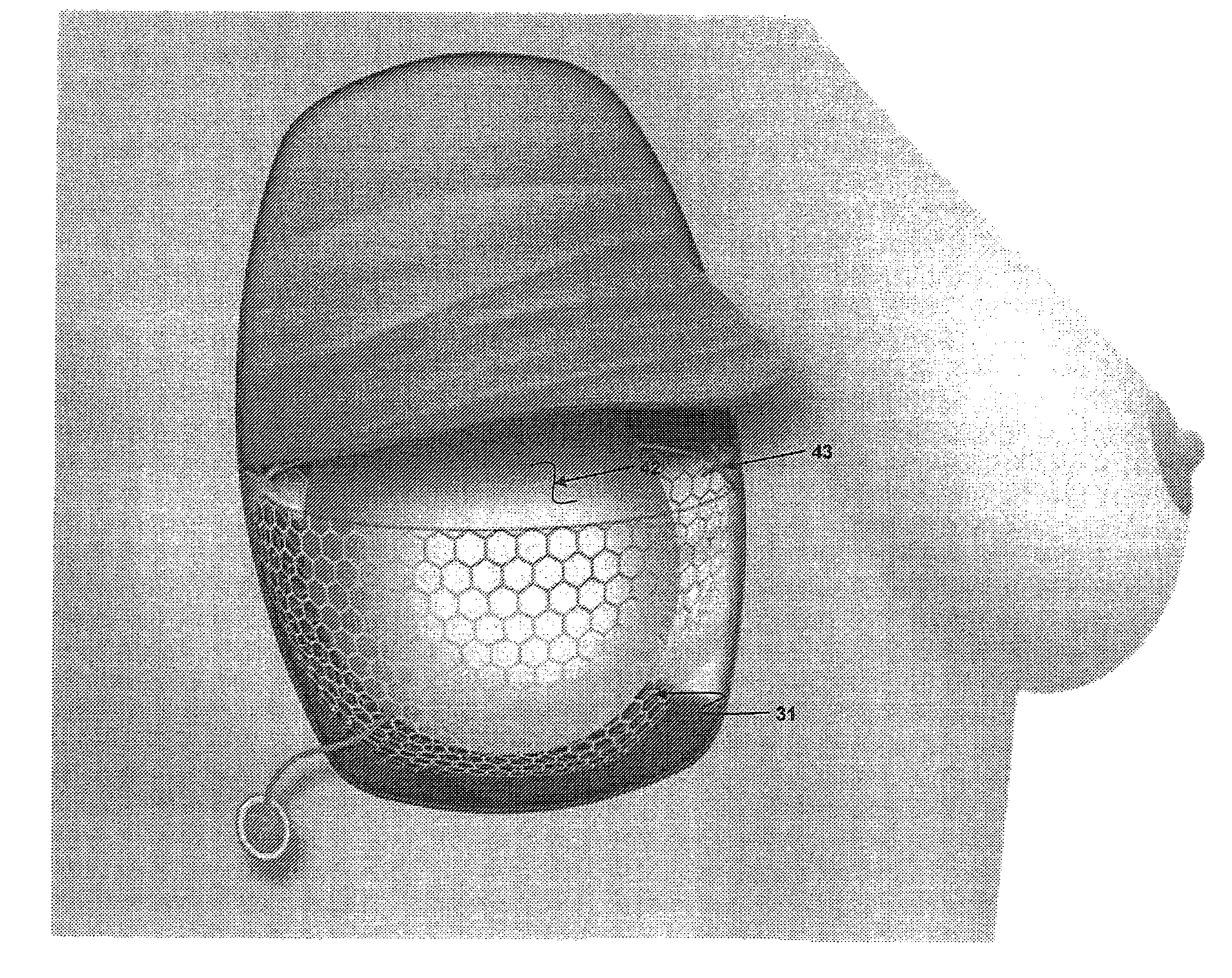 Supporting and Forming Transitional Material for Use in Supporting Prosthesis Devices, Implants and to Provide Structure in a Human Body