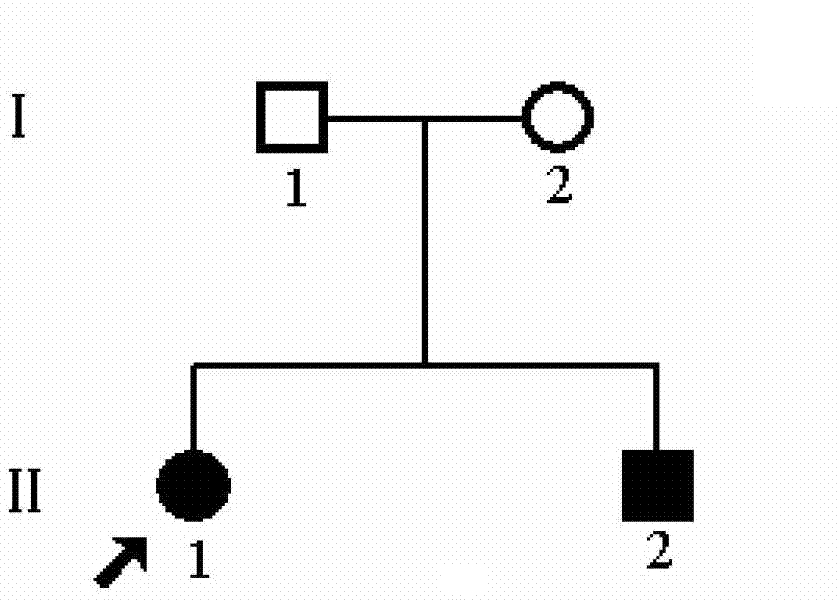 DRD (Dope-Reactive Dystonia)-related gene mutation and detecting method and usage thereof