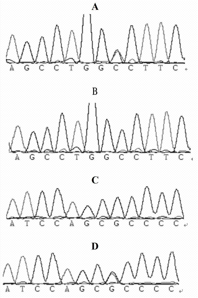 DRD (Dope-Reactive Dystonia)-related gene mutation and detecting method and usage thereof