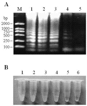 Primer group utilizing LAMP to detect vibrio alginolyticus and rapid diagnosis kit employing primer group