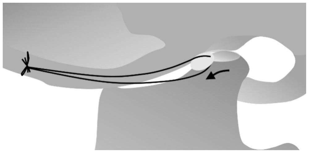 Construction method and application of condylar bone resorption animal model for temporomandibular joint osteoarthritis