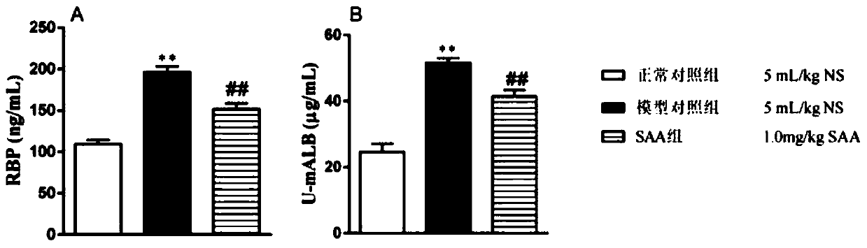 Use of salvianolic acid a as a medicine for preventing and treating diabetic eye disease