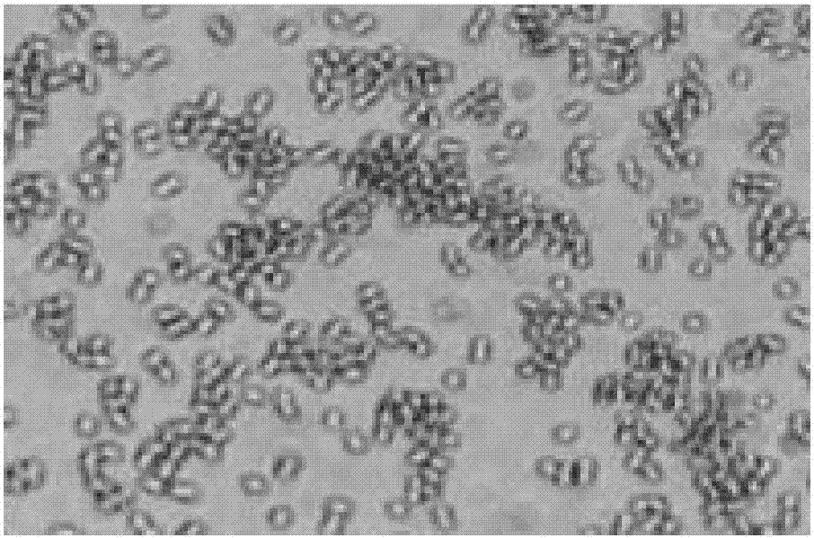 Aeromonas strain R1, preparation method of aeromonas strain and application of aeromonas strain in algae lysing and microcystin degradation