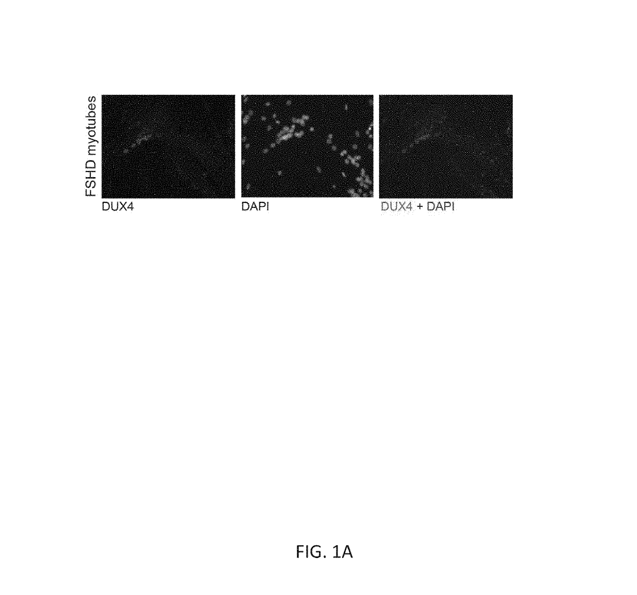 P38 kinase inhibitors reduce dux4 and downstream gene expression for the treatment of fshd