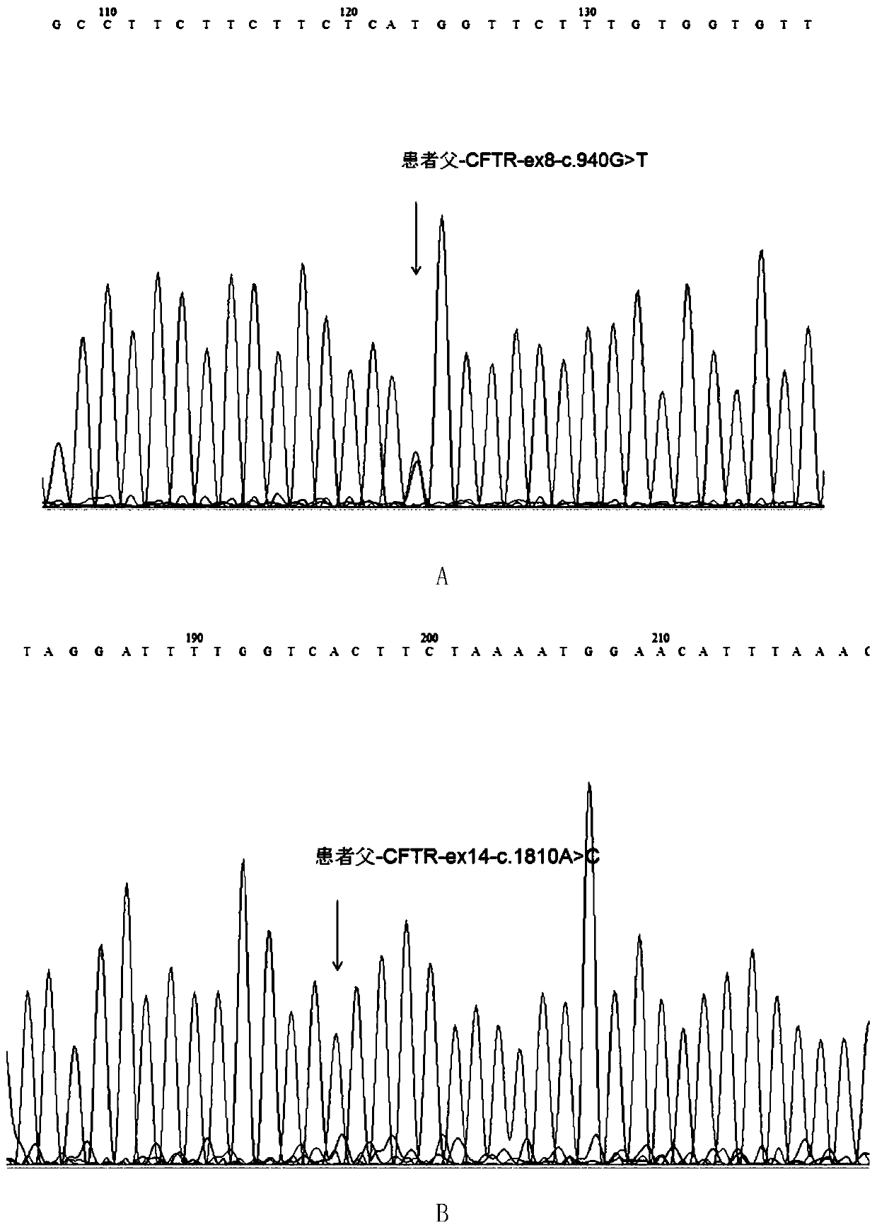 Mutated form of cftr gene in cystic fibrosis patients and its application