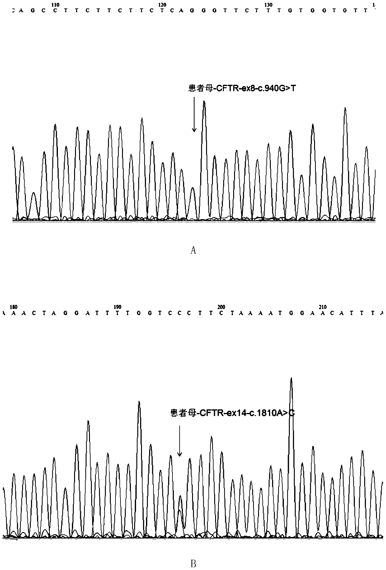 Mutated form of cftr gene in cystic fibrosis patients and its application