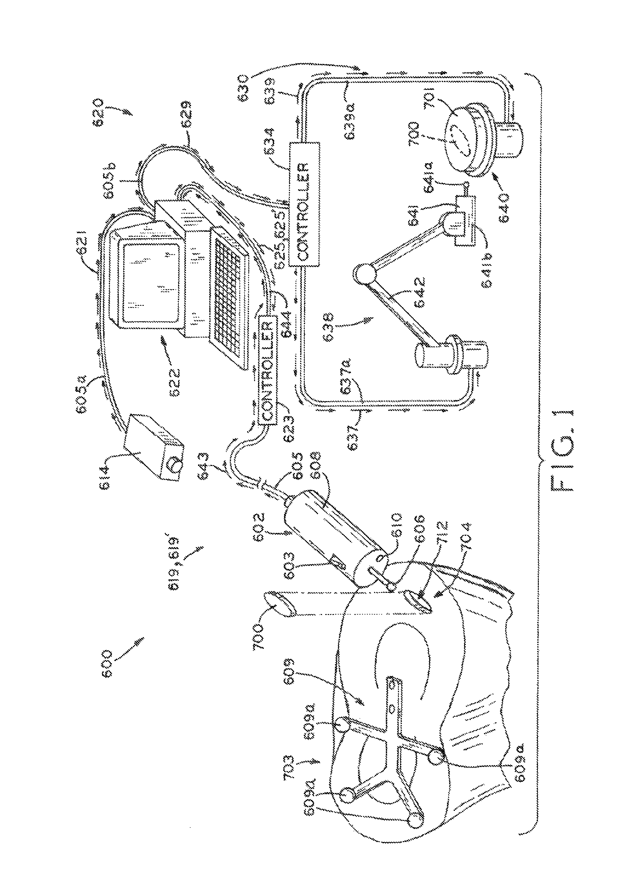 Tracked cartilage repair system