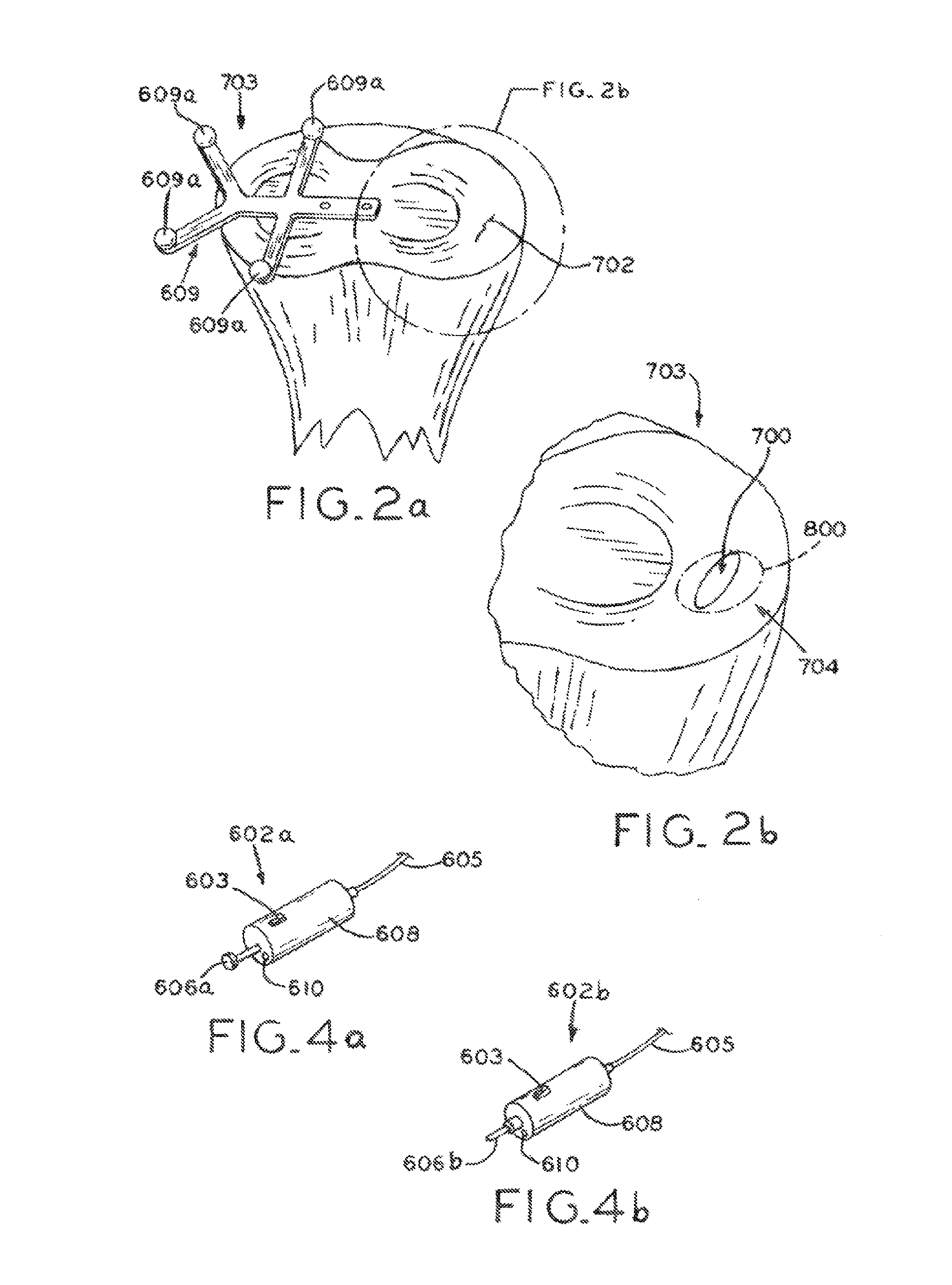 Tracked cartilage repair system