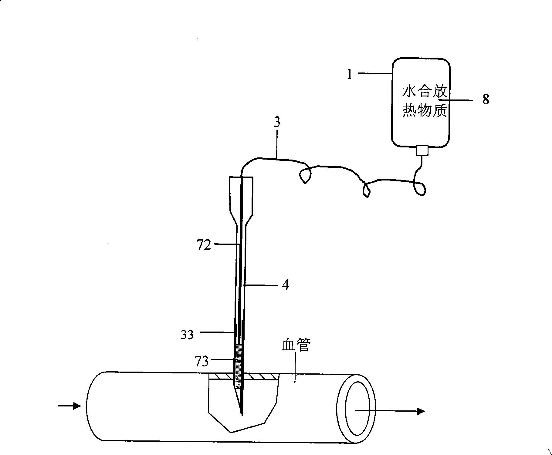 Intra-arterial heating infusion set and method