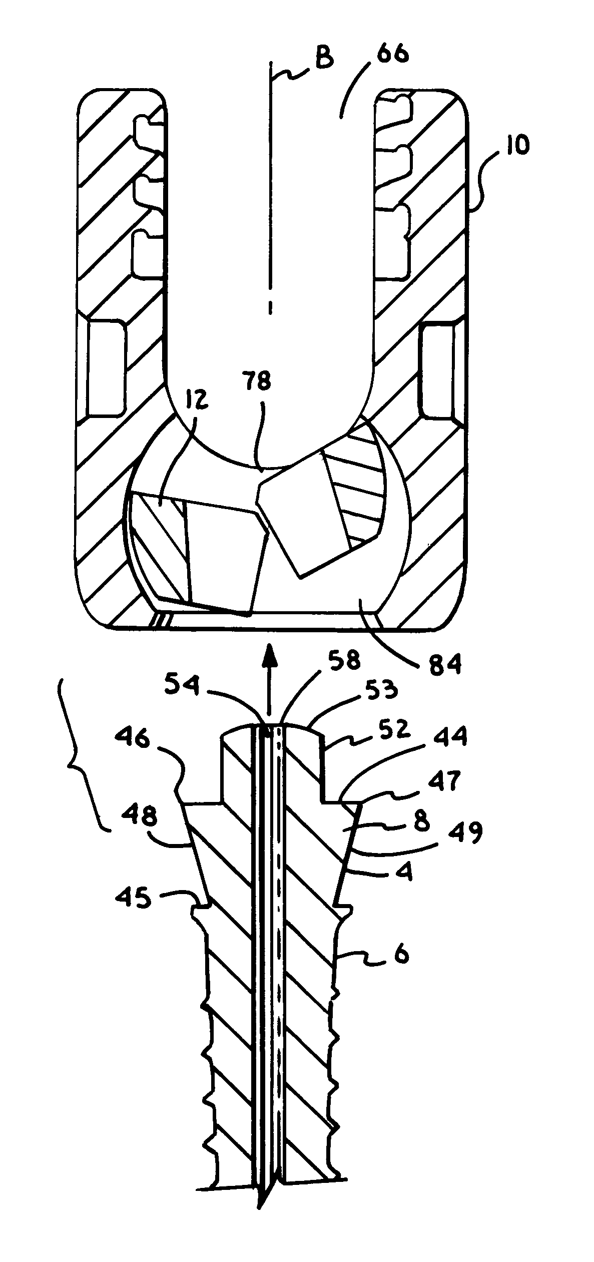 Polyaxial bone screw with multi-part shank retainer