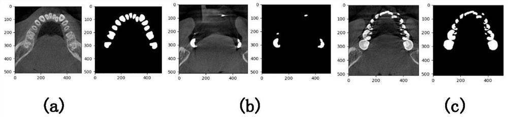 Dental CBCT three-dimensional tooth segmentation method based on deep learning