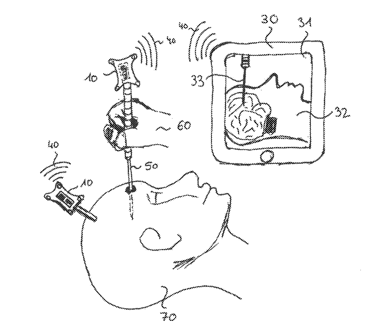 Redundant Reciprocal Tracking System