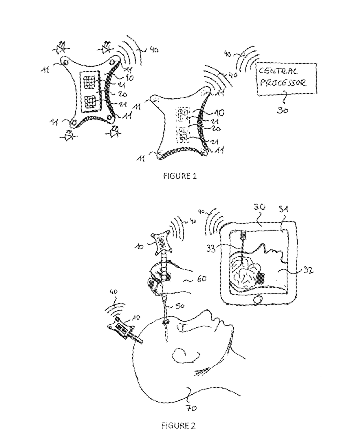 Redundant Reciprocal Tracking System