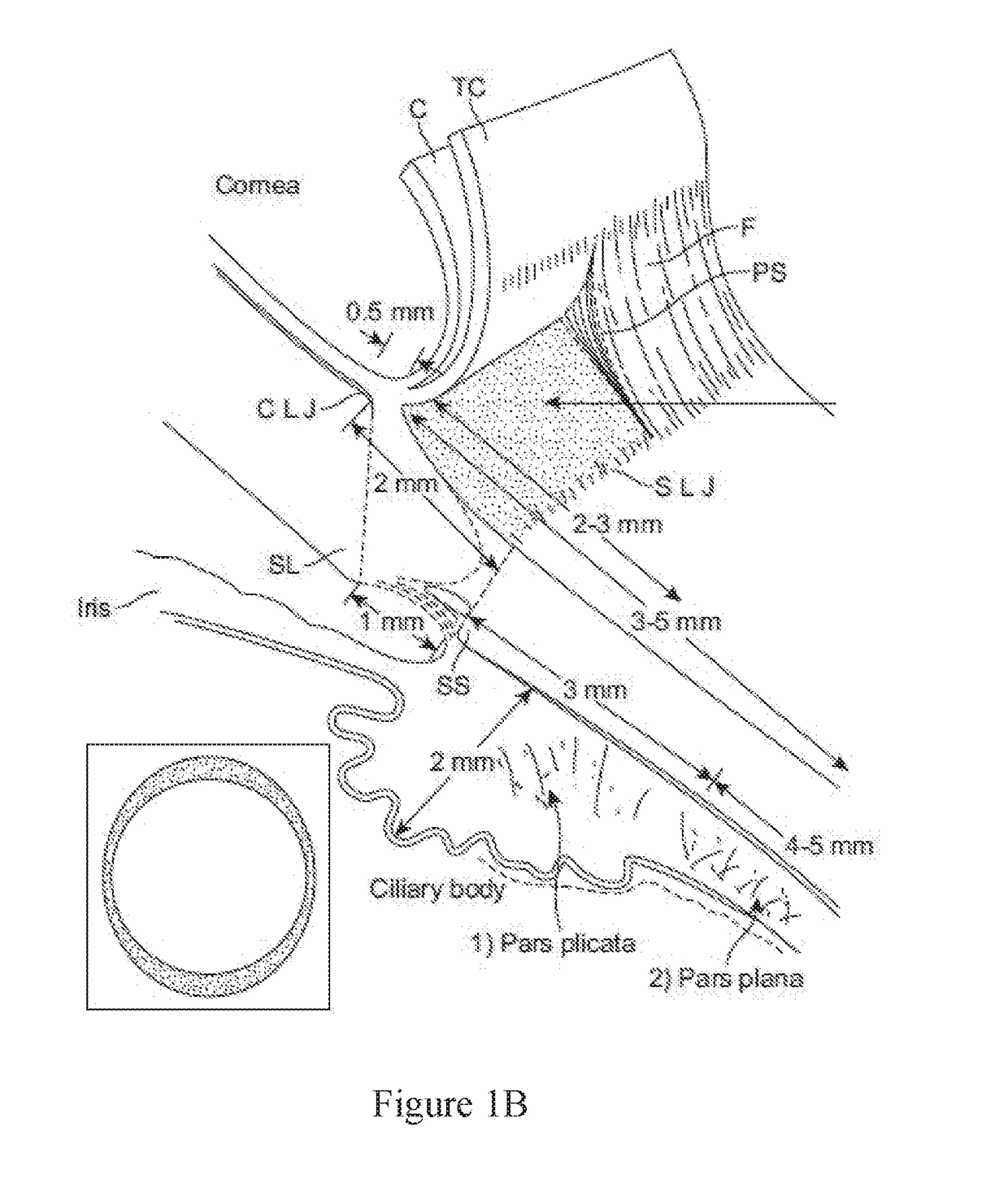 Convex contact probe for the delivery of laser energy