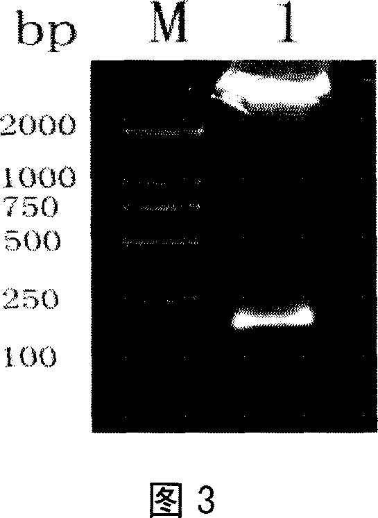 Pig's epidermal growth factor gene and its application