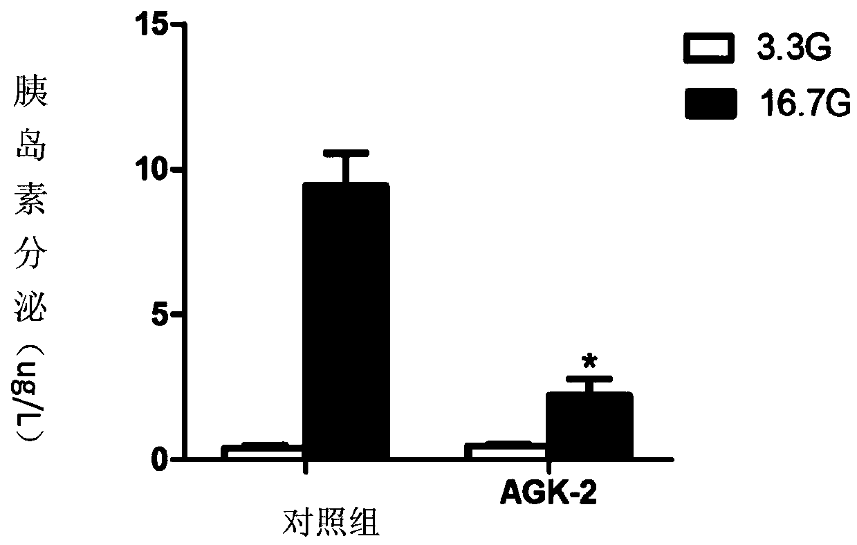 Application of SIRT2 inhibitor in pharmacy