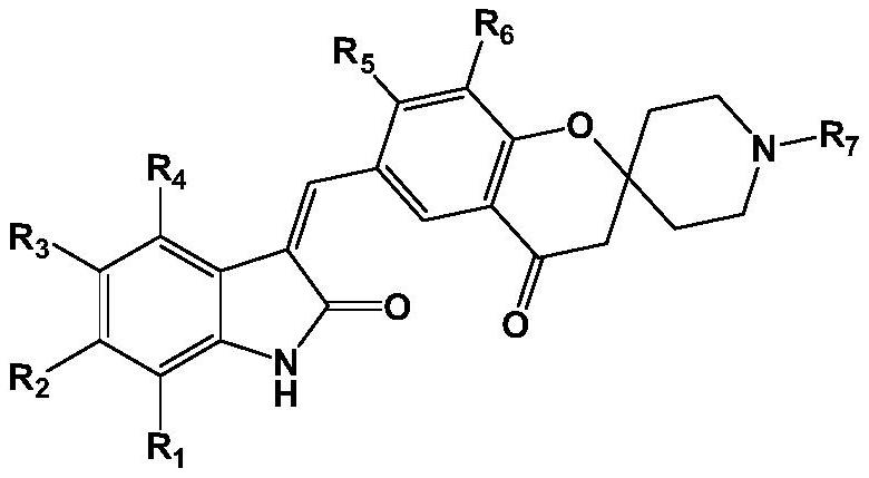 A kind of medicine for preventing and treating coronary heart disease and preparation method thereof