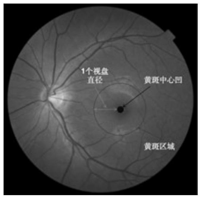 Eye fundus image recognition method and device, equipment, storage medium and program product