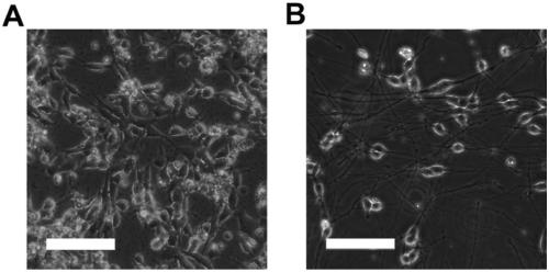 Method used for inducing differentiation of stem cells into neurone, neurone, and applications