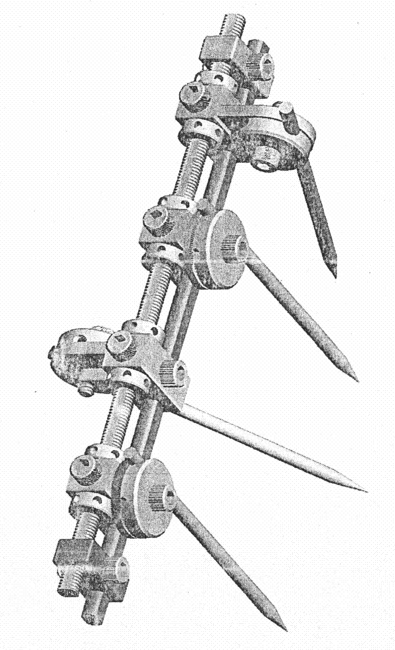 Double-track type external fixed bracket