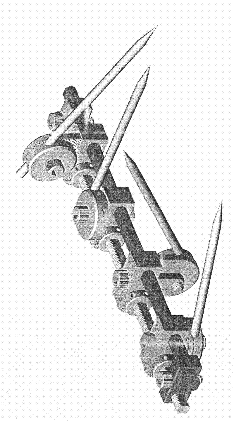 Double-track type external fixed bracket