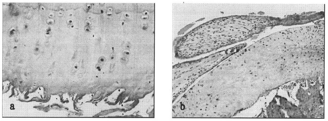 In vitro amplification culture method for rabbit subchondral bone osteoblasts, and application thereof