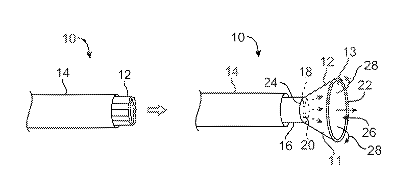 Integral electrode placement and connection systems