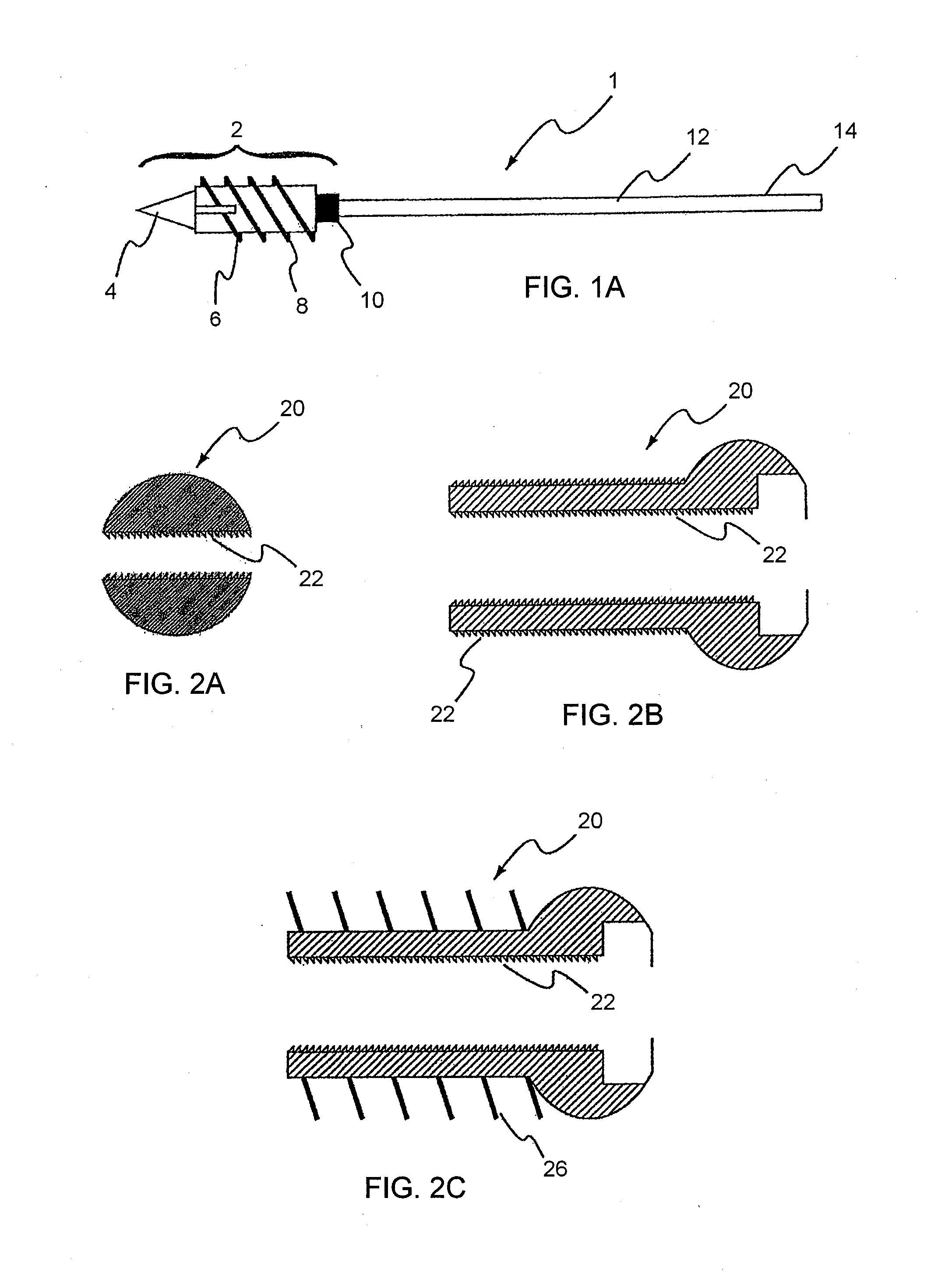 Tensioning system and method for the fixation of bone fractures