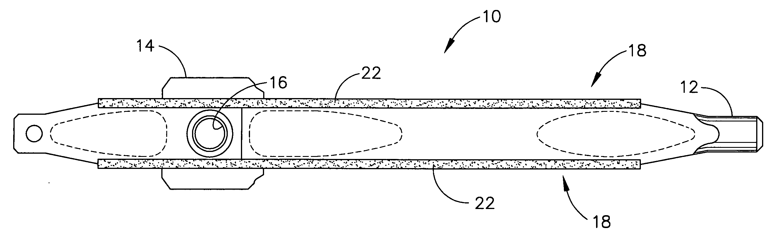 Aircraft wheel part having improved corrosion resistance