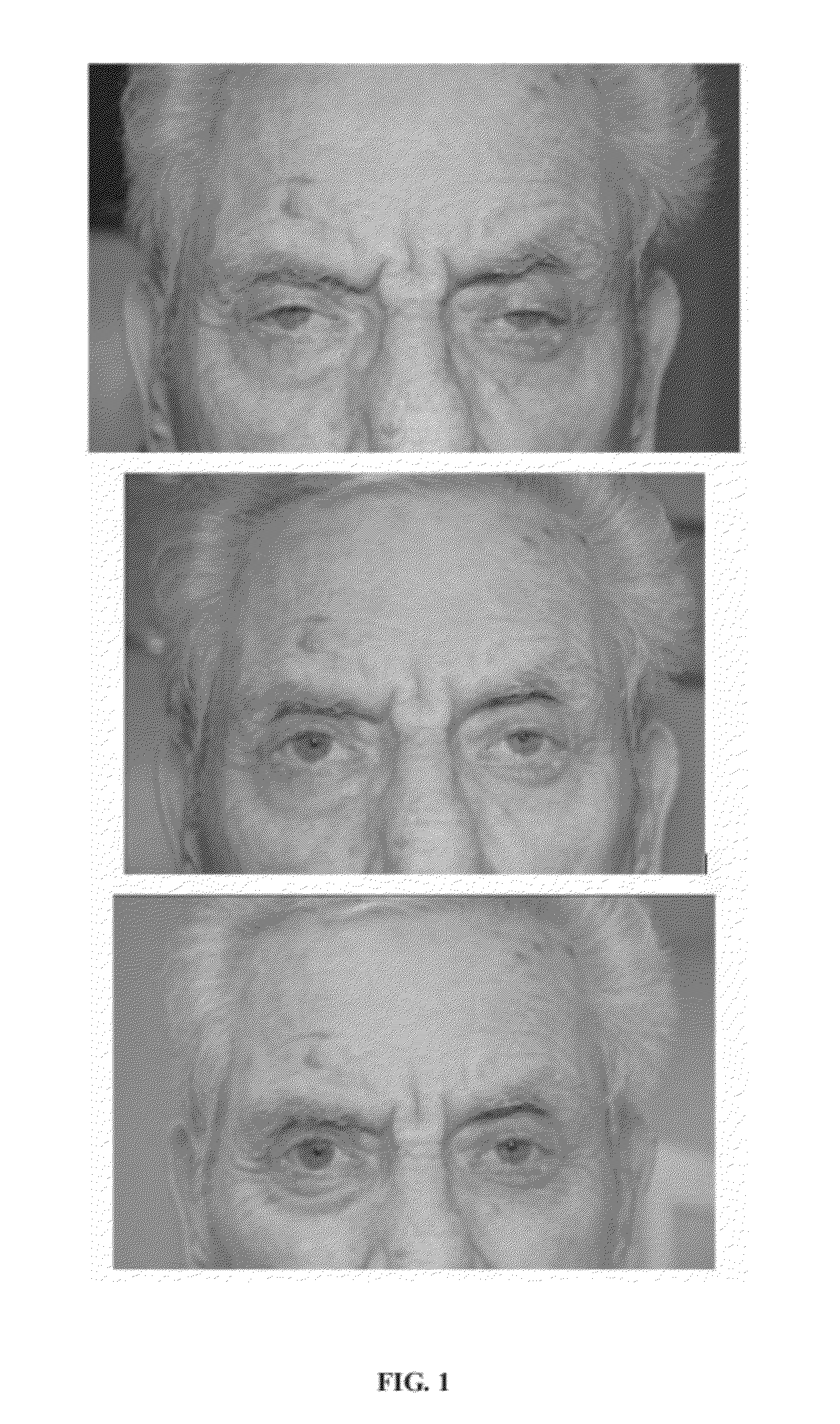 Compositions and Methods for Non-Surgical Treatment of Ptosis