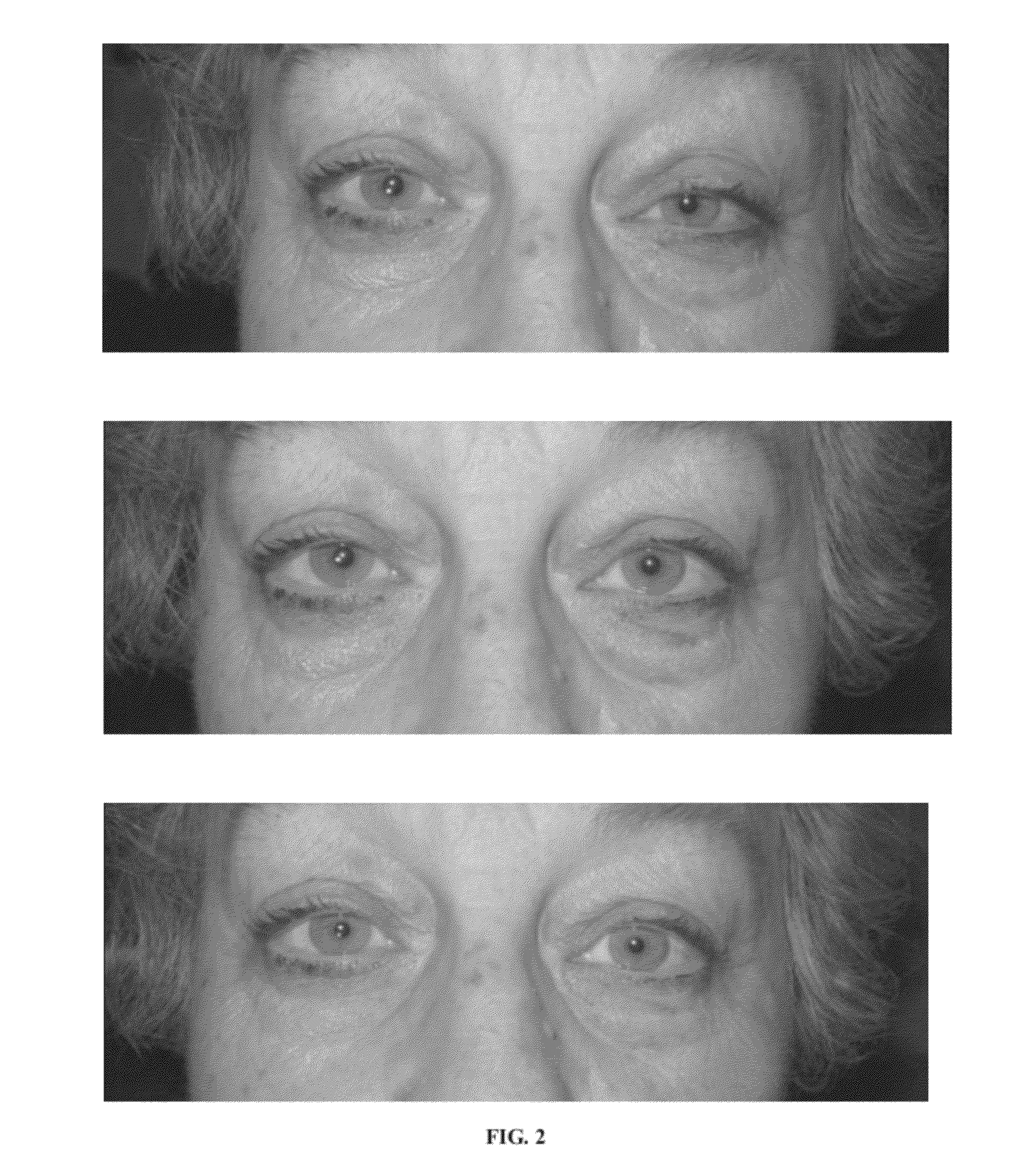 Compositions and Methods for Non-Surgical Treatment of Ptosis