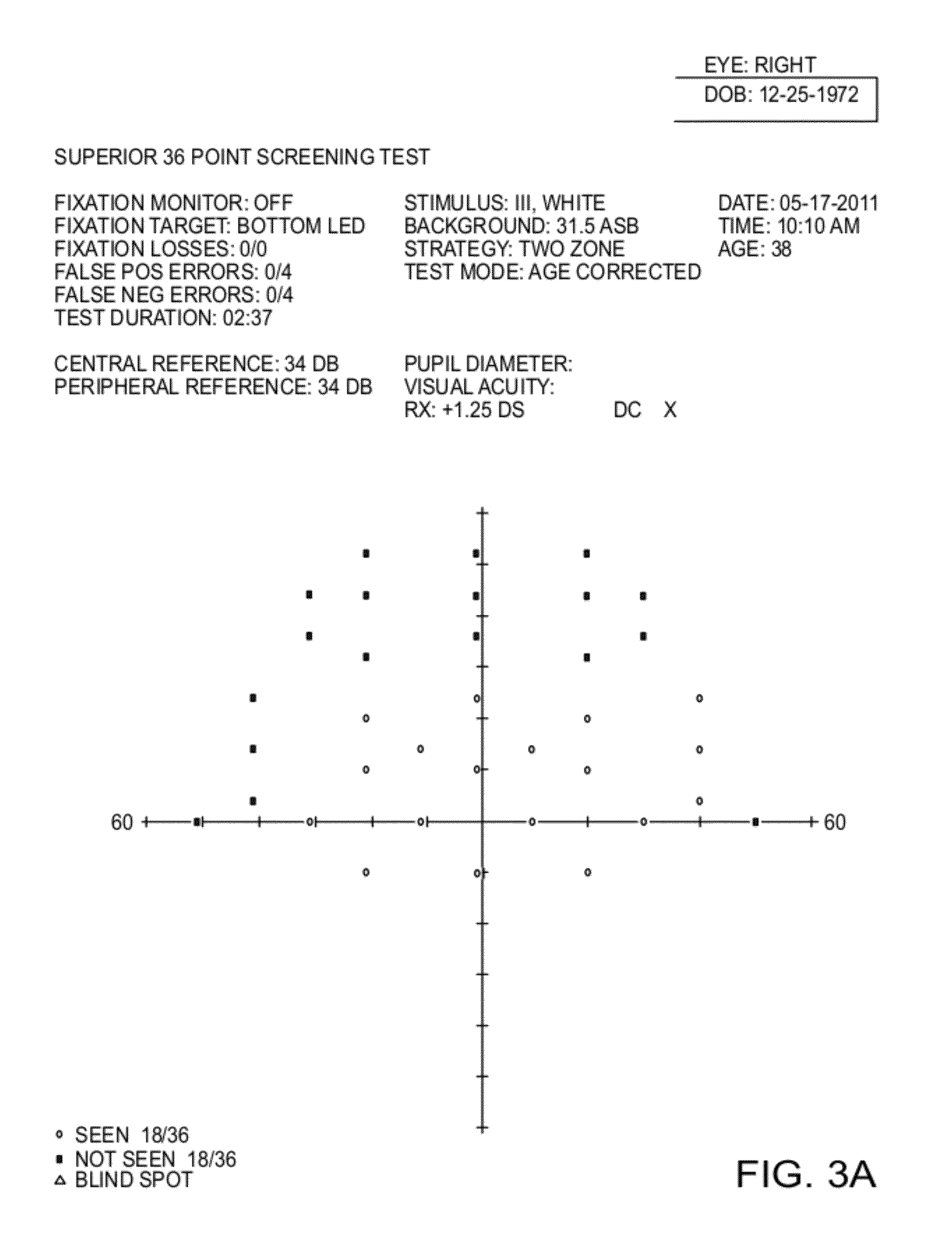 Compositions and Methods for Non-Surgical Treatment of Ptosis