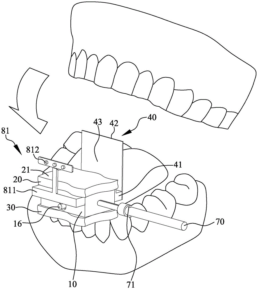 Occlusion positioning X-ray film holder